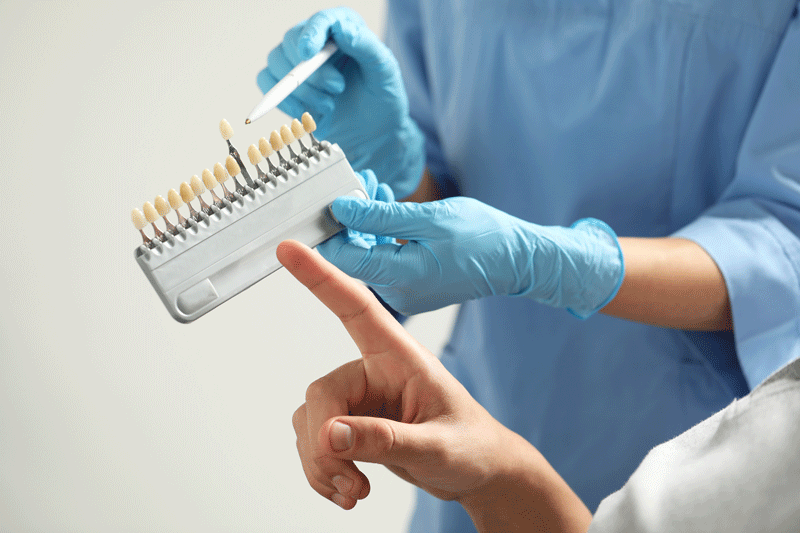 A close-up of a porcelain veneer being placed onto a dental model at Dentique clinic in Turkey, demonstrating the custom "Smile Makeover" process for a natural and aesthetic finish.