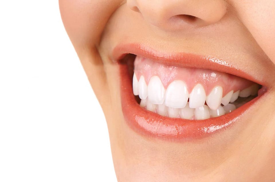 A close-up photo of a patient's smile after getting the gummy smile treatment in Turkey with Dentique clinic.