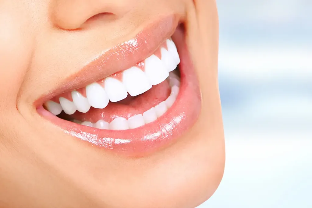 Hollywood Smile in Turkey: Beyond the Myth of Perfect White Teeth